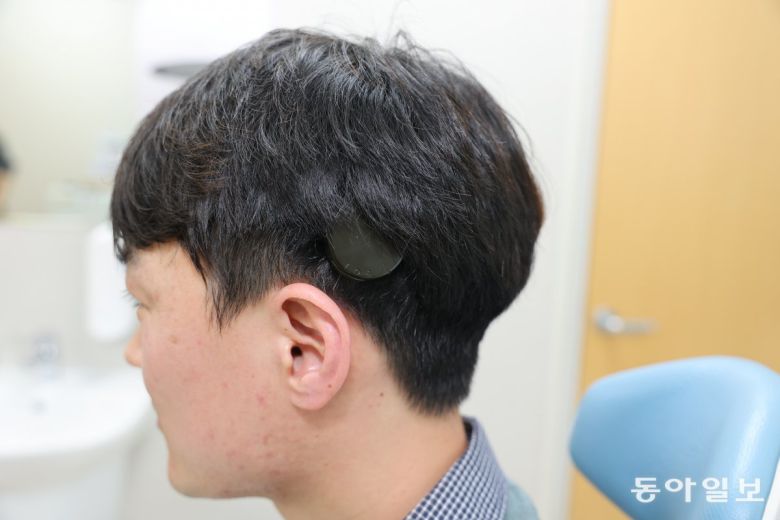 전정엽 씨가 인공와우 장치를 착용한 상태. 귀 뒤쪽으로 노출된 것이 어음처리기다. 세브란스병원 제공