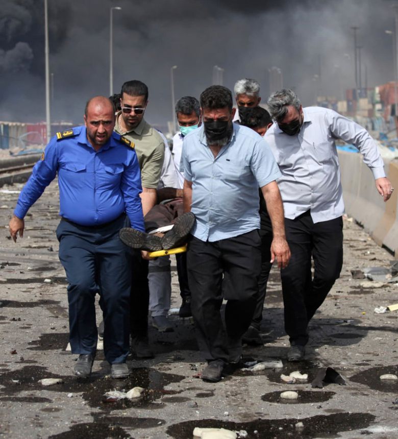 폭발 현장의 부상자가 들것에 실려 이송되고 있다. 현지 시간 27일 오후 1시 기준 28명이 숨지고 800여 명이 부상을 당한 가운데 실종자, 중상자가 많아 사상자가 늘어날 가능성이 제기된다. 반다르아바스=AP 뉴시스