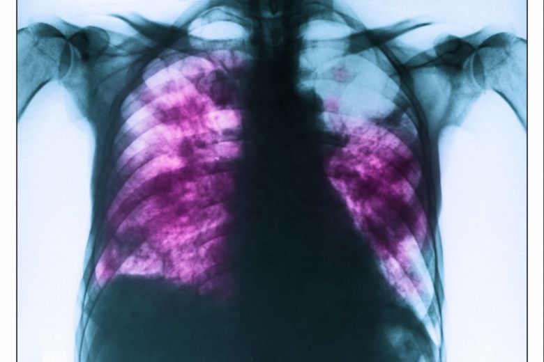 사진=게티이미지코리아.