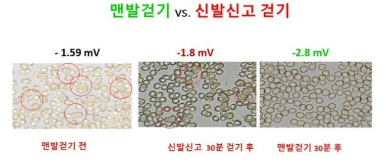 1. 걷기 전(맨 왼쪽)엔 적혈구들이 덩어리지어 포도송이처럼 엉겨 붙어 있는 모습이 보인다. 특히 빨간 원 안을 보면, 마치 찐 밥알이 서로 달라붙어 있는 것처럼 뭉쳐 있다. 이는 혈액의 점성이 높아지고, 산소 공급과 노폐물 제거가 원활하지 못한 상태일 수 있음을 의미한다. 2. 신발 신고 걷기 30분 후(가운데)에는 적혈구들이 약간 분리됐지만 여전히 몇 개씩 뭉쳐 있는 모습이다. 3. 맨발걷기 30분 후(오른쪽)에는 적혈구들이 하나하나 독립적으로 분산되어 있다. 이는 혈액이 훨씬 부드럽게 흐르고, 산소와 영양소를 더 효과적으로 전달할 수 있는 상태임을 시사한다. 맨발걷기국민운동본부 제공.