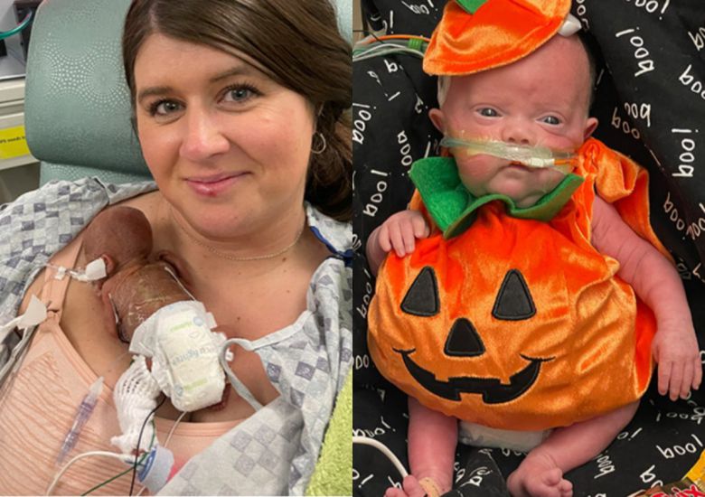 미국에서 임신 21주, 예정일보다 133일 앞서 태어난 아기 ‘내쉬 킨’이 생후 1년을 맞아 기네스 세계 최연소 생존 신생아로 등재됐다. 출생 당시 무게는 285g, 키는 24cm에 불과했으며, 복숭아보다 작은 몸으로 생존해 전 세계에 감동을 전했다. (사진=기네스 월드 레코드)