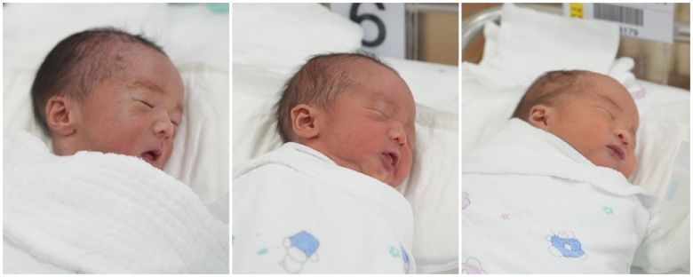 분당서울대병원 제공