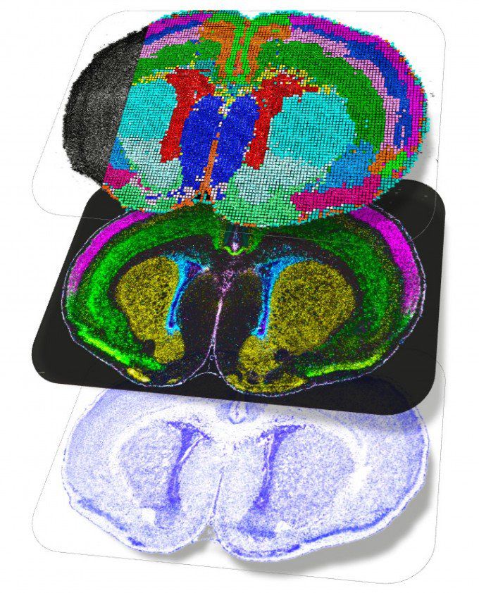 출생 직후 쥐의 뇌 공간 지도. 단백질이나 리보핵산(RNA) 등이 실제로 뇌의 어느 위치에서 상호작용하는지를 보여준다. 네이처 제공