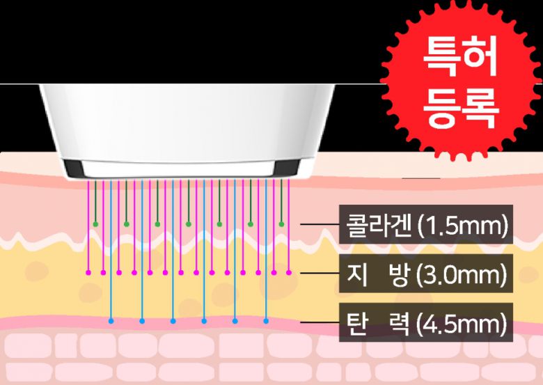 (이미지 출처 : 아벨테크 제공)