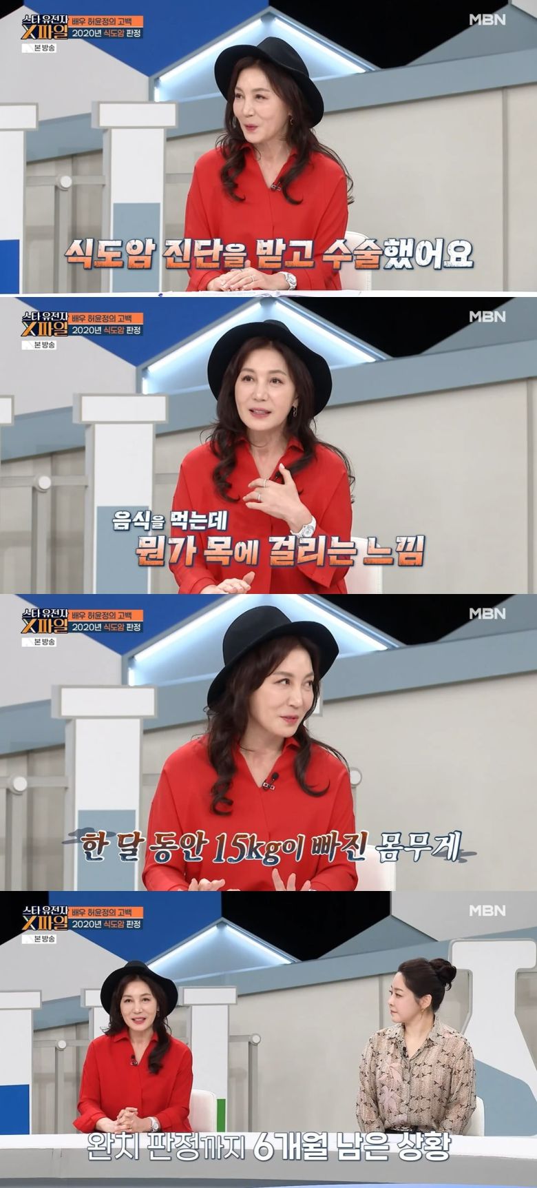 사진 = MBN '임성훈의 스타 유전자 X파일'