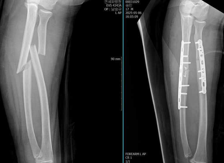 사진=오윤아 SNS