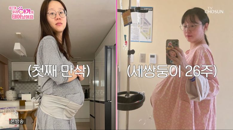 사진=TV조선 '우리 아기가 태어났어요'