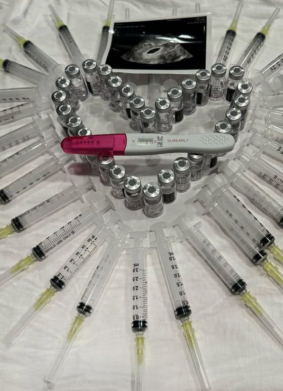 사진=아야네 SNS