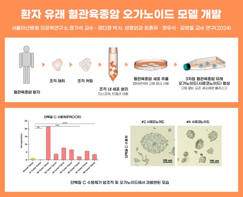 환자 유래 혈관육종암 오가노이드 모델 개발