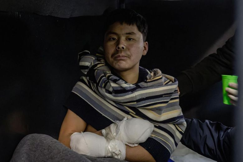 우크라이나에 생포된 북한군. AFP연합뉴스