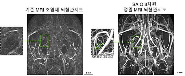 [대전=뉴시스] SAIO 뇌혈관 지도. SAIO를 활용해 쥐의 뇌를 MRI로 촬영한 모습으로 머리카락 굵기(100㎛)의 미세혈관까지 선명히 볼 수 있는 3차원 정밀 MRI 뇌혈관 지도를 구현할 수 있다. *재판매 및 DB 금지