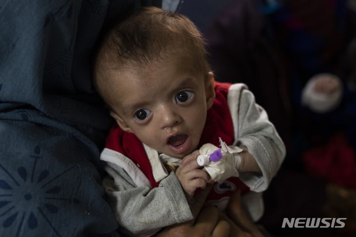 [카불=AP/뉴시스] 지난 2일(현지시간) 아프가니스탄 카불의 아타투르크 국립 소아병원 영양실조 병동에서 한 아이가  치료 받고 있다. 2021.12.23.