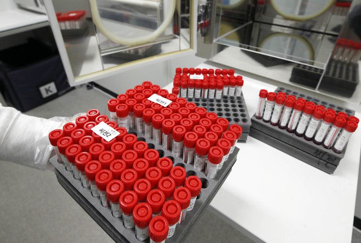 [광주=뉴시스] 코로나19 검체통. (사진=광주 북구 제공) 2022.07.26. photo@newsis.com *재판매 및 DB 금지