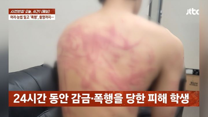 [서울=뉴시스] 18일 JTBC '사건반장'에 따르면 피해 학생인 중학교 3학년 A군의 아버지와의 인터뷰를 공개했다. (사진= JTBC 캡처 ) 2025.03.20. photo@newsis.com *재판매 및 DB 금지