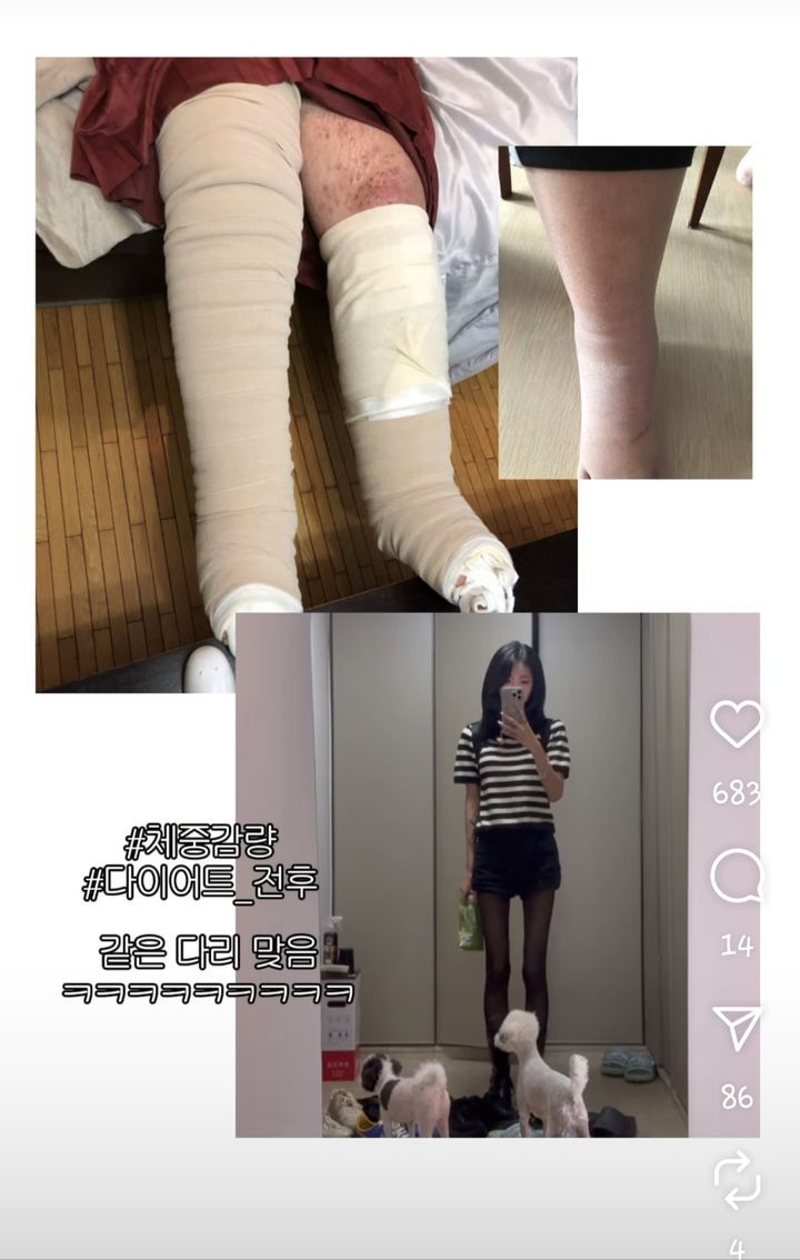 [서울=뉴시스] 인플루언서 최준희가 다이어트 전후 모습을 공개했다. (사진=최준희 인스타그램 캡처) 2025.04.22. photo@newsis.com *재판매 및 DB 금지