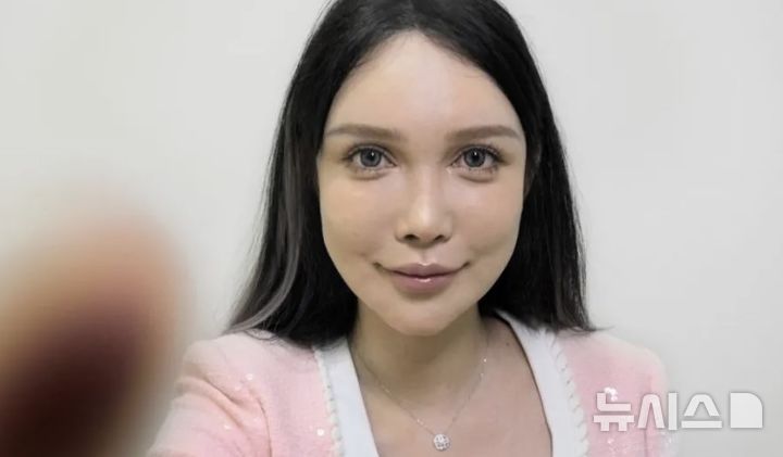 [서울=뉴시스]애비 우의 성형 후 모습(사진=BBC)