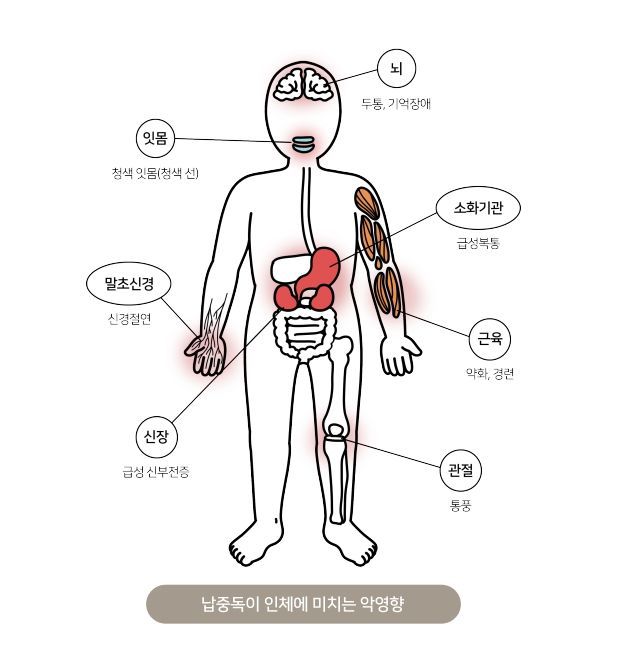 [서울=뉴시스] 9일 식품의약품안전처가 발간한 '유해물질 간편정보지'에 따르면 납은 소화관에서 흡수율이 높아 오랫동안 섭취하면 사람의 장기나 조직에 쌓여 건강을 해칠 수 있다. (사진=식약처 제공) 2025.07.09. photo@newsis.com *재판매 및 DB 금지