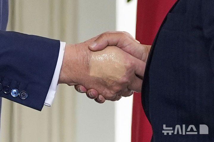 [워싱턴=AP/뉴시스]지난 16일 미국 워싱턴DC에서 살만 빈 하마드 알 칼리파 바레인 왕사자와 악수하는 도널드 트럼프 대통령의 손등에 멍을 가리가 위한 화장자국이 선명하다. 2025.07.18.