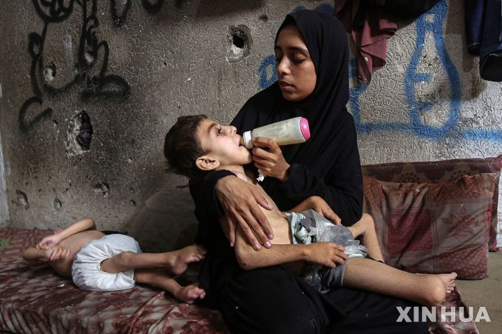 [가자시티=신화/뉴시스] 지난 25일(현지 시간) 가자지구 가자시티의 한 대피소에서 영양실조와 뇌성마비로 고통받는 팔레스타인 어린이들이 누워 있는 모습. 2025.07.27.