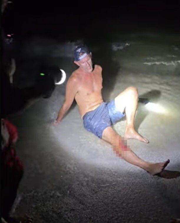 [서울=뉴시스] 미국 플로리다 해변에서 상어를 건져올린 한 남성이 기념사진을 찍으려다 상어의 습격을 받는 사고가 발생했다. (사진=데일리메일 갈무리) 2025.08.23 *재판매 및 DB 금지