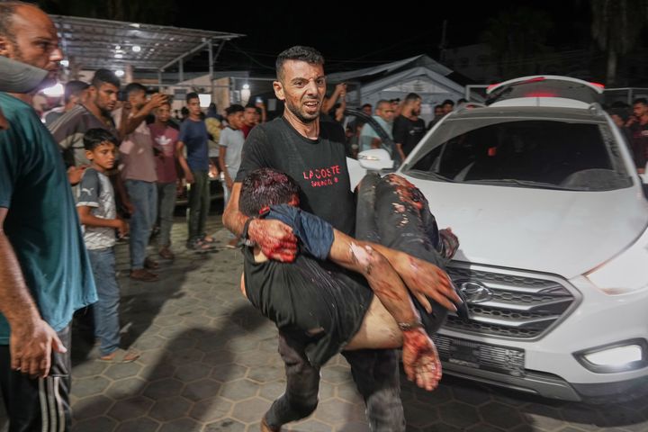 [데이르알발라=AP/뉴시스]   가자지구 중부 데이르알발라 시내에서 한 남성이 이스라엘군의 목공소와 카페 공습으로 부상한 남성을 알아크사 병원으로 옮기고 있다. 2025.10.02.