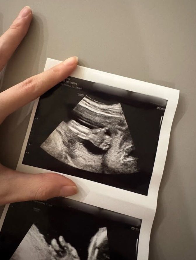 [서울=뉴시스] 아나운서 출신 방송인 오상진·김소영 부부가 둘째를 품에 안게 됐다. 김소영은 5일 자신의 소셜미디어에 둘째 초음파 사진을 공개하며 "우리 가족에게 또 한 명의 아기가 찾아왔다"고 둘째 임신 소식을 전했다. (사진=김소영 인스타그램 캡처) 2025.12.06. photo@newsis.com *재판매 및 DB 금지