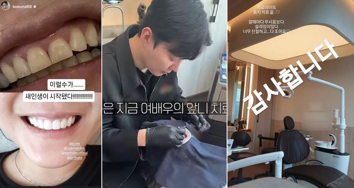 배우 고은아가 최근 제로네이트 시술 전·후 사진을 공개했다. 사진 | 고은아 SNS