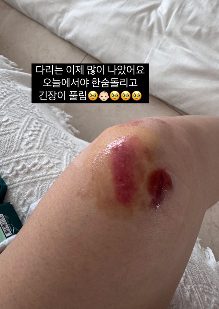 사진 | 김지혜 SNS