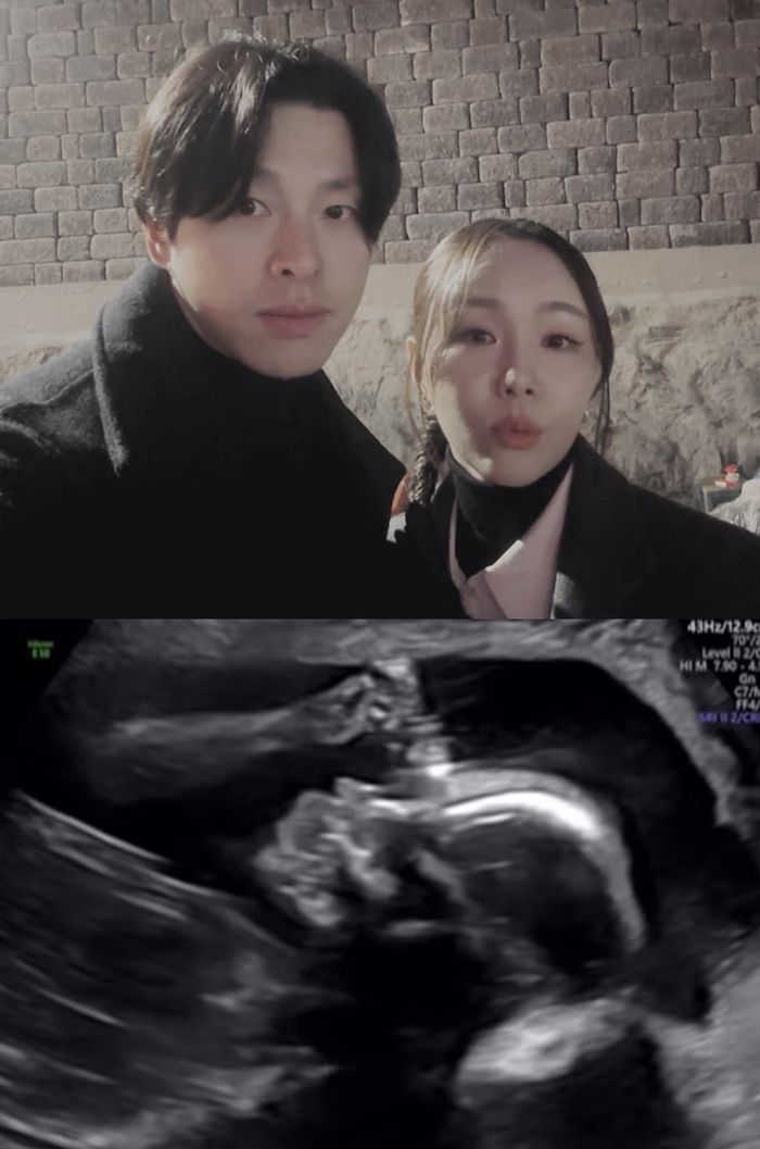 임정희(오른쪽)-김희현 부부와 초음파  영상 캡쳐