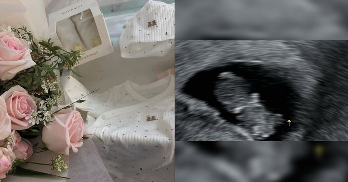 유나 인스타그램.