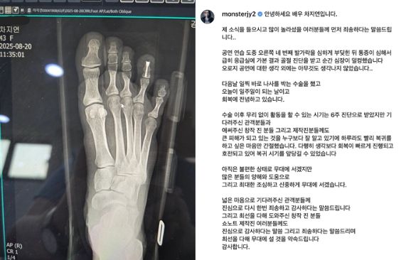 차지연이 28일 개인 SNS에 부상 당시 촬영한 X-레이와 함께 근황과 사과 인사를 전했다. 사진 | 차지연 SNS