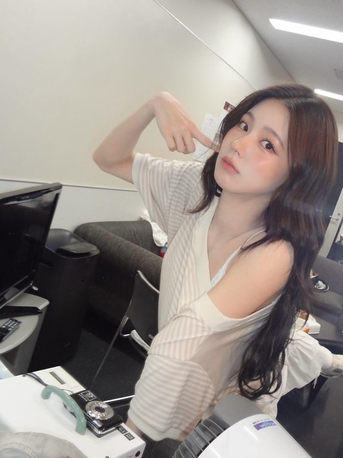 사진 | 아이들 미연 SNS