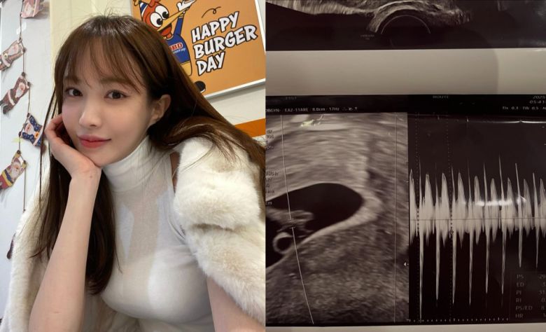 서민재 / 사진=서민재 인스타그램